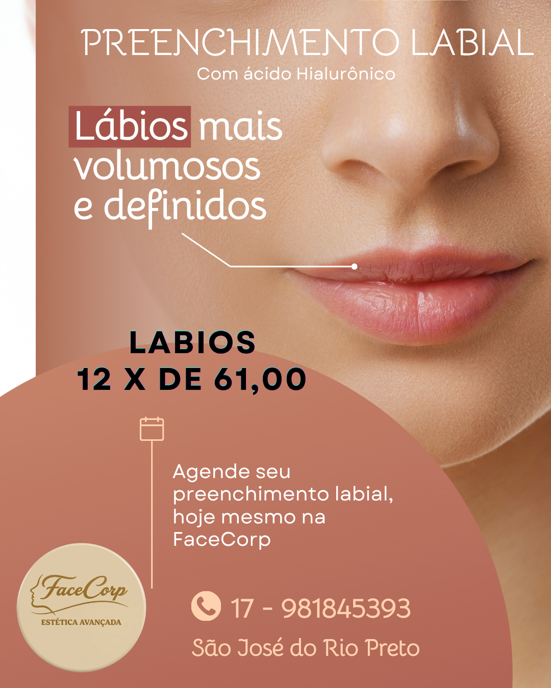 Story Instagram Preenchimento Labial Beleza Estética Elegante Bege (Post para Instagram (45)).png